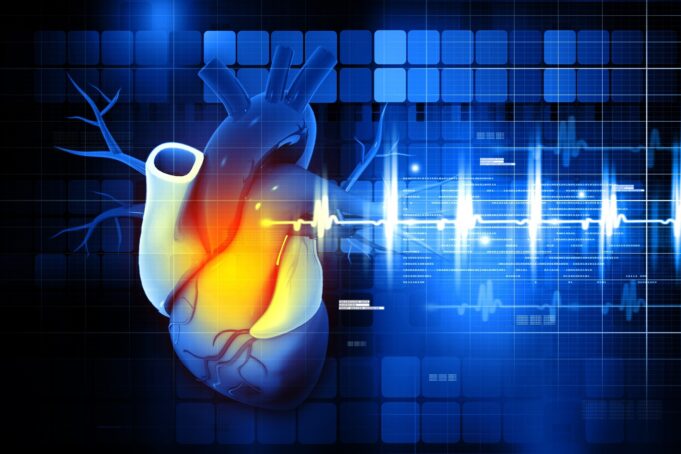 Study: Rare and Common Genetic Variation Underlying Atrial Fibrillation Risk. Image Credit: hywards / Shutterstock