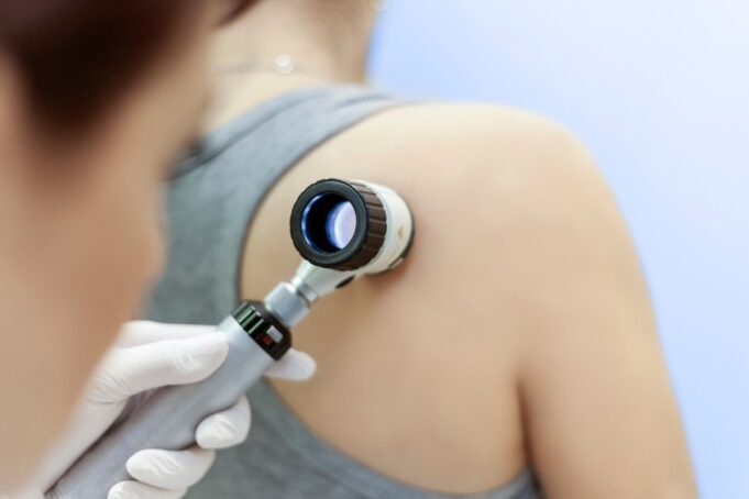 Study: Evidence-Based Communication to Increase Melanoma Knowledge and Skin Checks. Image Credit: Healthy Definition/Shutterstock.com