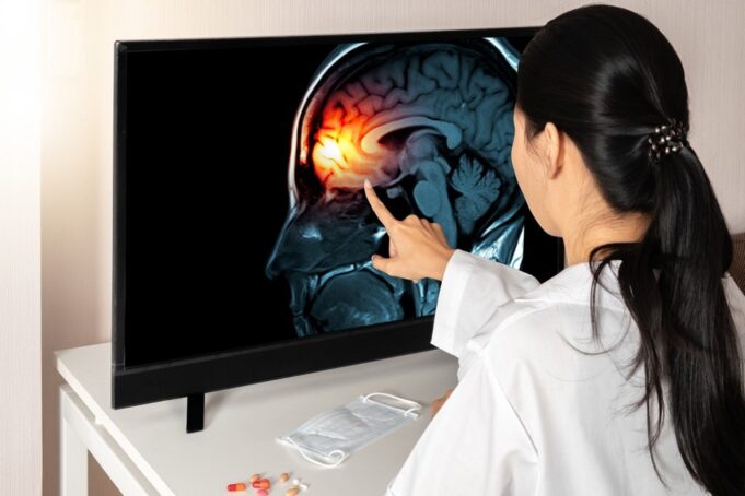 Study: Divergent landscapes of A-to-I editing in postmortem and living human brain. Image Credit: steph photographies/Shutterstock.com